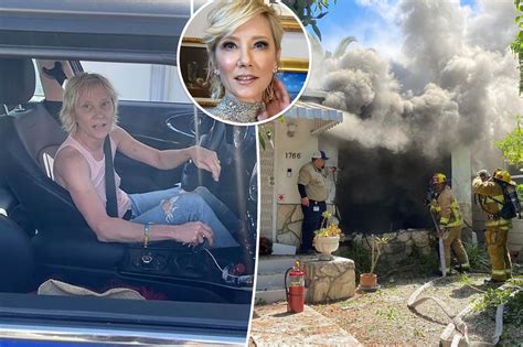 Anne Heche was involved in a fiery car crash on Friday that has left her "severely burned" and "intubated" in the hospital, TMZ reports. . Anne heche autopsy photo
